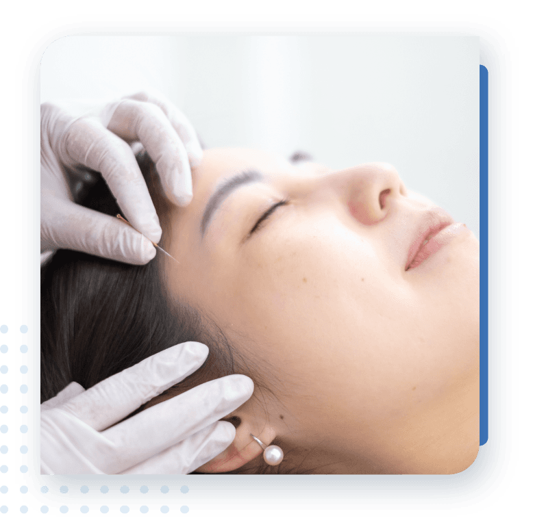 คนไข้รักษาด้วยการฝังเข็มแบบแพทย์แผนจีน